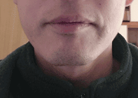 ダイエットをする前のデブ顔